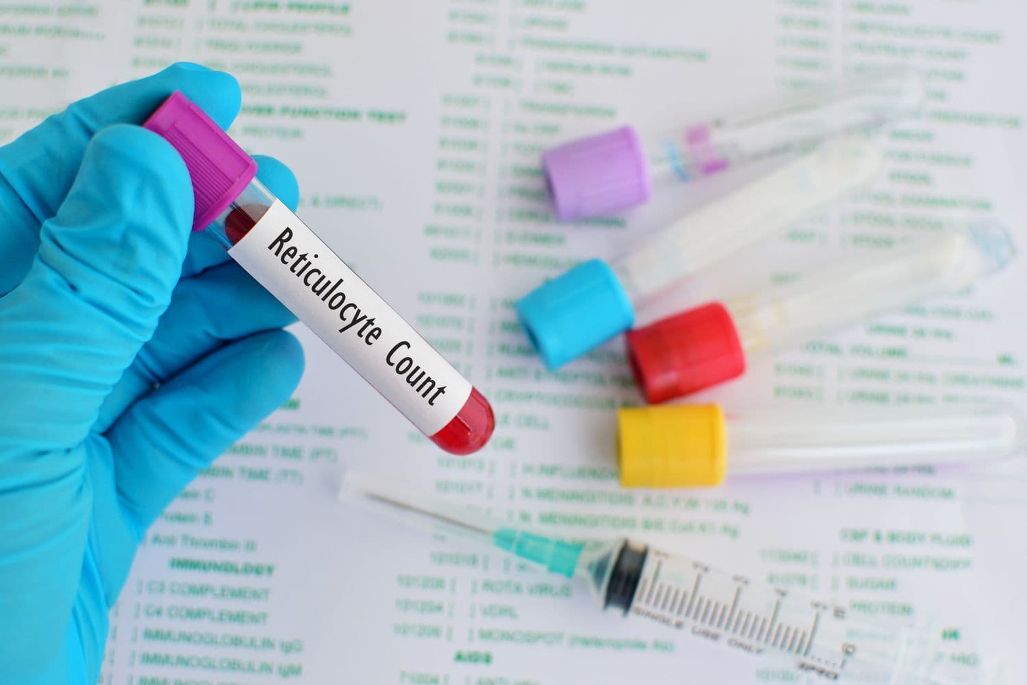 Reticulocyte Count